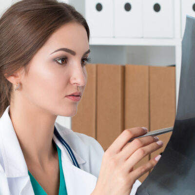 Causes and symptoms of Idiopathic Pulmonary Fibrosis