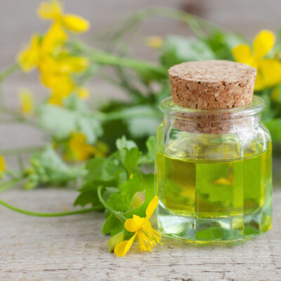 Home Remedies for Eczema