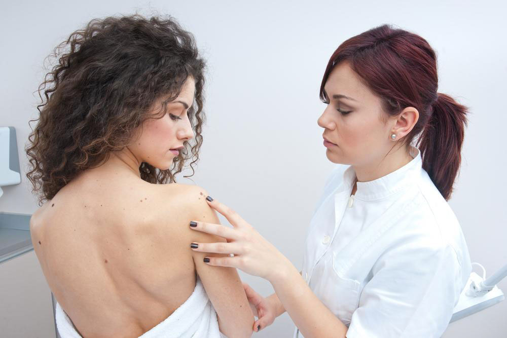 The causes and types of melanoma